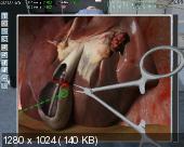  Chirurgie-Simulator 2011